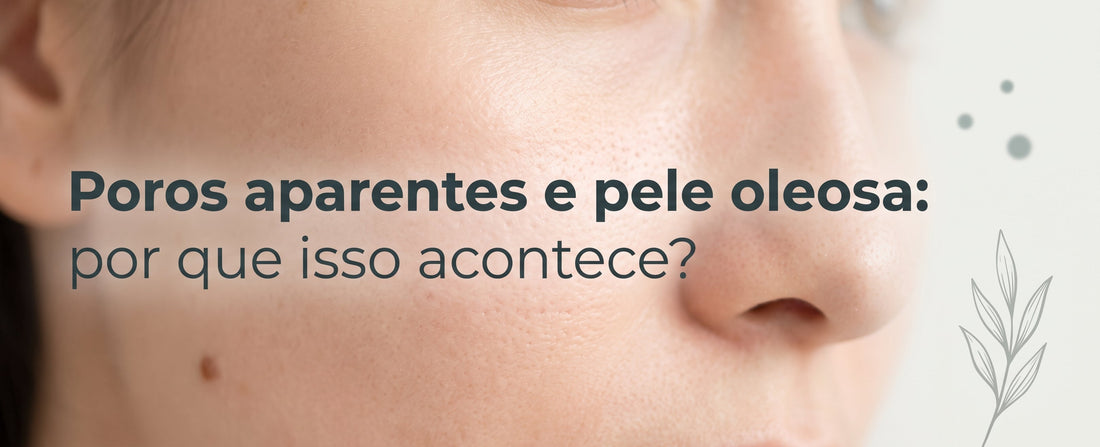 Poros aparentes e pele oleosa: por que isso acontece?